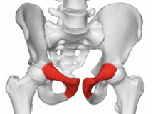 Pubalgie et sport : fini les protocoles standards, place à l’exercice sur mesure