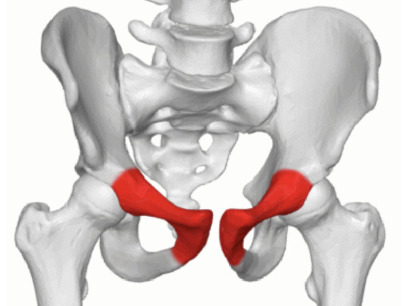 Pubalgie et sport : fini les protocoles standards, place à l’exercice sur mesure