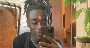 Après le diamant dans le front, Lil Uzi Vert veut implanter une puce cérébrale Après le diamant dans le front, Lil Uzi Vert veut implanter une puce cérébrale