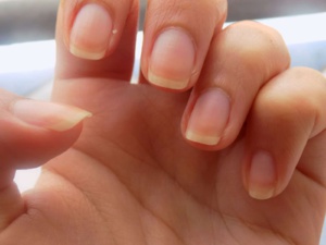 Jaunissement des ongles : Causes et remèdes Jaunissement des ongles : Causes et remèdes