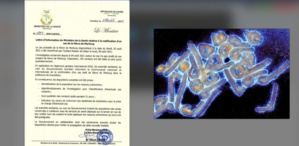 Virus Marburg : quelle est cette maladie qui vient d'être détectée ? Virus Marburg : quelle est cette maladie qui vient d'être détectée ?