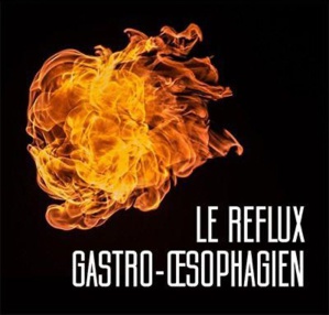 Le reflux Gastro-oesophagien Le reflux Gastro-oesophagien