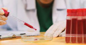 Cholestérol : beurre ou pas beurre !? Cholestérol : beurre ou pas beurre !?