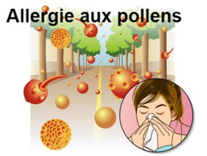 Allergies au pollen : des remèdes naturels existent Allergies au pollen : des remèdes naturels existent