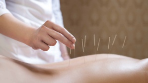  l’acupuncture est-elle efficace pour augmenter ses performances sportives ?