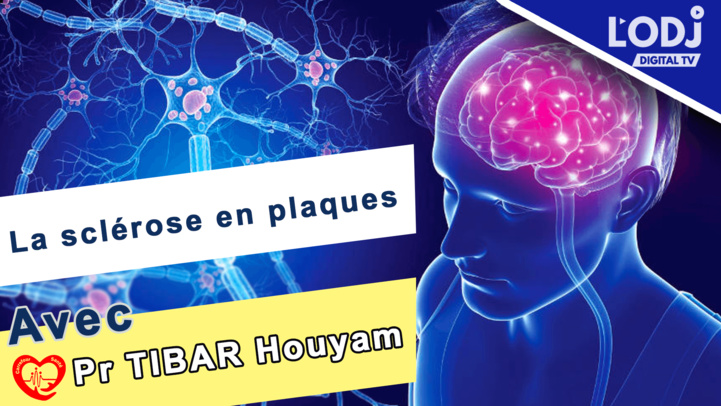 Carrefour santé sur la sclérose en plaques Carrefour santé sur la sclérose en plaques