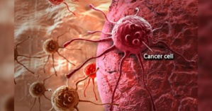 Des scientifiques israéliens développent l’IA pour traiter le cancer Des scientifiques israéliens développent l’IA pour traiter le cancer