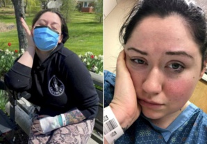 Etats-Unis : Une femme "allergique à la gravité" ne peut pas se tenir debout sans s'évanouir