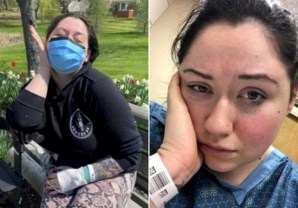 Etats-Unis : Une femme "allergique à la gravité" ne peut pas se tenir debout sans s'évanouir Etats-Unis : Une femme "allergique à la gravité" ne peut pas se tenir debout sans s'évanouir