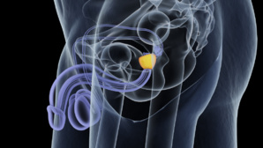 Problémes de prostate ! 10 questions à votre médecin Problémes de prostate ! 10 questions à votre médecin