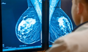 Cancer du sein : une intelligence artificielle pourra aider au diagnostic Cancer du sein : une intelligence artificielle pourra aider au diagnostic