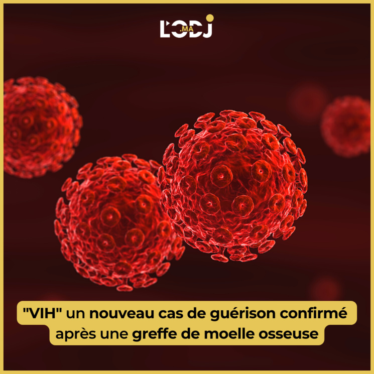 "VIH" un nouveau cas de guérison confirmé après une greffe de moelle osseuse "VIH" un nouveau cas de guérison confirmé après une greffe de moelle osseuse