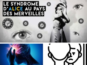 Le syndrome d'Alice au pays des merveilles, cette affection neurologique qui provoque des perturbations visuelles Le syndrome d'Alice au pays des merveilles, cette affection neurologique qui provoque des perturbations visuelles