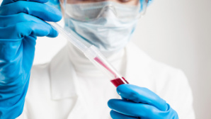 Hémophilie : près de 4.000 Marocains touchés par la maladie Hémophilie : près de 4.000 Marocains touchés par la maladie