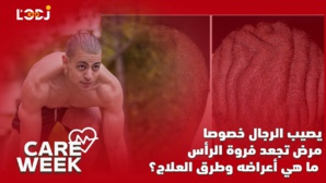 Notre chronique sur le sujet Notre chronique sur le sujet