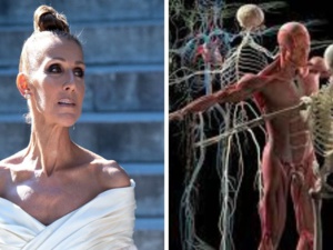 La maladie de Céline Dion La maladie de Céline Dion