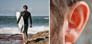 Exostose : Comprendre la maladie des surfeurs Exostose : Comprendre la maladie des surfeurs