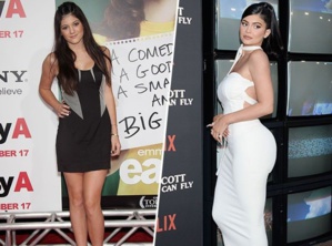 Kylie Jenner affirme avoir des regrets concernant la chirurgie esthétique Kylie Jenner affirme avoir des regrets concernant la chirurgie esthétique