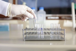 UCPVax : Le vaccin thérapeutique anticancer UCPVax : Le vaccin thérapeutique anticancer