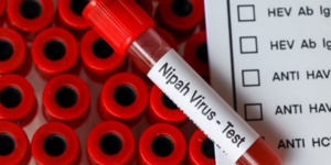 Nipah : virus qui sévit en Inde ? Nipah : virus qui sévit en Inde ?