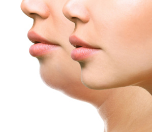 Double Menton : Voici les exercices à faire pour maigrir du visage