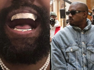 Kanye West dévoile ses nouvelles dents en titane