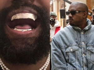 Kanye West dévoile ses nouvelles dents en titane Kanye West dévoile ses nouvelles dents en titane