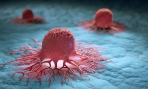 Cancer : l'OMS alerte sur une explosion des cas à l'horizon 2050 Cancer : l'OMS alerte sur une explosion des cas à l'horizon 2050