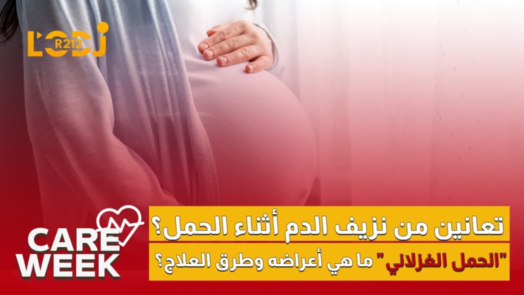 Care Week : تعانين من نزيف الدم أثناء الحمل؟ "الحمل الغزلاني"، ما هي أعراضه وطرق العلاج؟