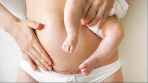 Césarienne : entre tabous, traumatismes et besoins d'accompagnement