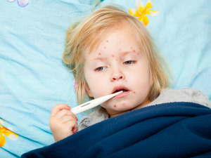 Texas : 24 cas de rougeole en deux semaines Texas : 24 cas de rougeole en deux semaines