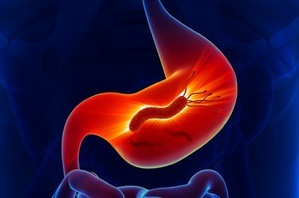 La bactérie de l’estomac : un fléau silencieux qui touche 7 Marocains sur 10