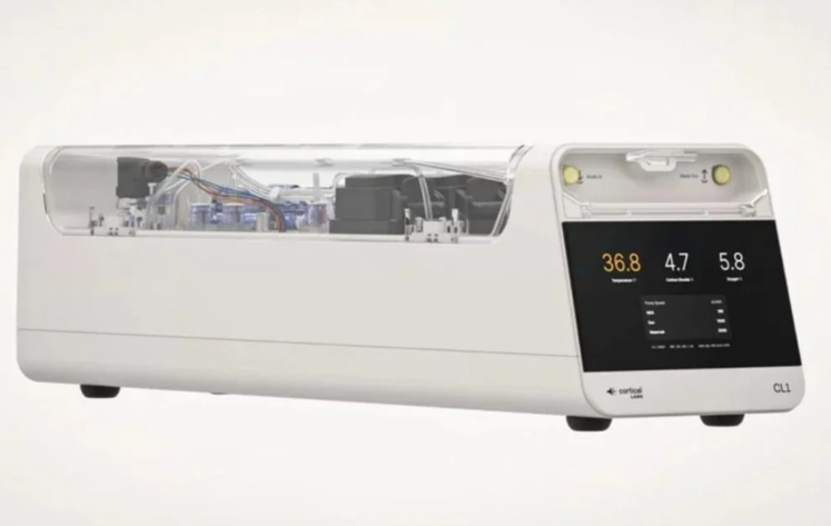 Un ordinateur à base de neurones humains : révolution ou cauchemar éthique ? Un ordinateur à base de neurones humains : révolution ou cauchemar éthique ?