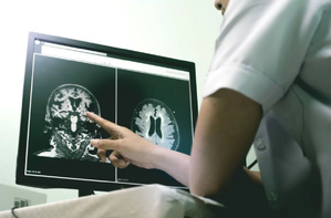 Rééducation post-AVC : une aide venue de l’IA ? Rééducation post-AVC : une aide venue de l’IA ?