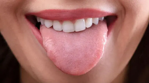 Regarde ta langue, elle a quelque chose à te dire Regarde ta langue, elle a quelque chose à te dire