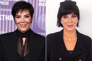 Kris Jenner défie le temps : son visage rajeuni fascine le monde Kris Jenner défie le temps : son visage rajeuni fascine le monde