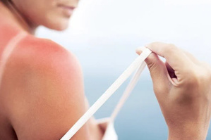 Burn lines : quand le bronzage devient un coup de soleil volontaire Burn lines : quand le bronzage devient un coup de soleil volontaire