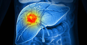 Hépatites : la menace est réelle, même sans symptômes Hépatites : la menace est réelle, même sans symptômes