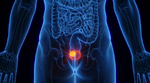 Cancer de la vessie : un virus courant serait-il en cause ?