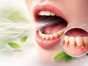 Respirer par la bouche Respirer par la bouche