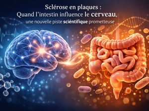 Sclérose en plaques