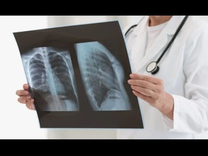 Diagnostiquer la pneumonie en un souffle : le capteur révolutionnaire du MIT Diagnostiquer la pneumonie en un souffle : le capteur révolutionnaire du MIT