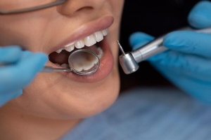 L’exercice illégal des soins dentaires inquiète au Maroc : l’ONMD tire la sonnette d’alarme