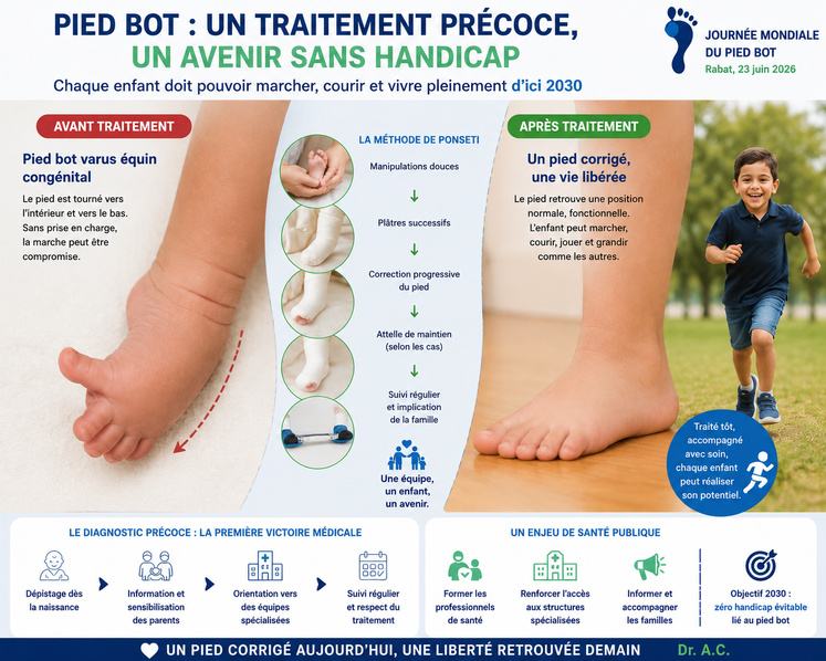 Pied bot chez l’enfant : une naissance différente, mais un avenir sans handicap grâce au traitement précoce.