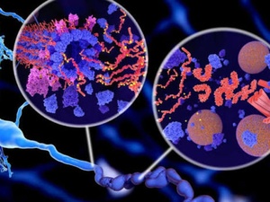 Alzheimer : une protéine naturellement présente dans le cerveau pourrait limiter les dommages liés à la maladie