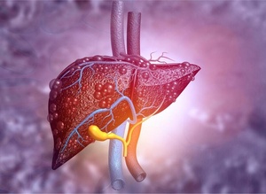 Cancer du foie : vers un nouveau traitement ? Cancer du foie : vers un nouveau traitement ?