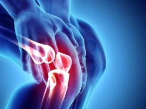 Polyarthrite : cette thérapie cellulaire reprogramme le système immunitaire et place trois patients sur six en rémission