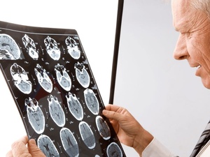 Vieillissement du cerveau : pourquoi stimuler ses capacités peut faire la différence