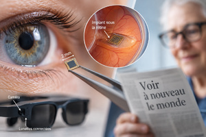 DMLA : enfin une puce capable de restaurer une partie de la vision perdue DMLA : enfin une puce capable de restaurer une partie de la vision perdue