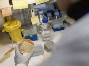 Microbiote : cette enzyme découverte par l’Institut Pasteur pourrait changer notre compréhension des microbes intestinaux